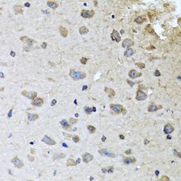 Immunohistochemistry  - BRCA1 antibody (A0212)