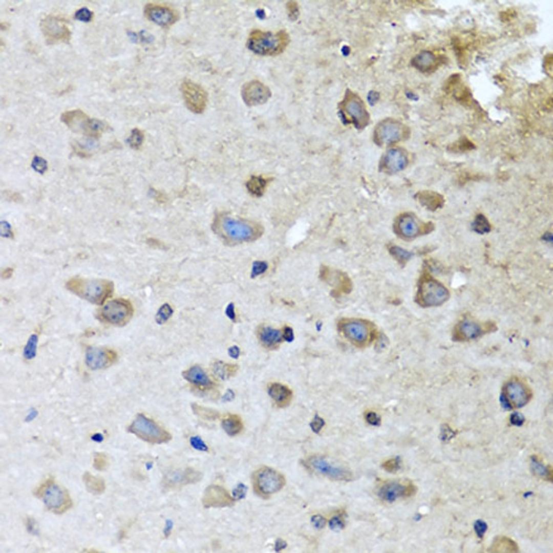 Immunohistochemistry - BRCA1 antibody (A0212)