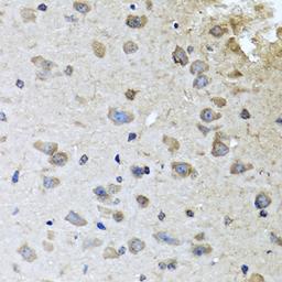 Immunohistochemistry - BRCA1 antibody (A0212)