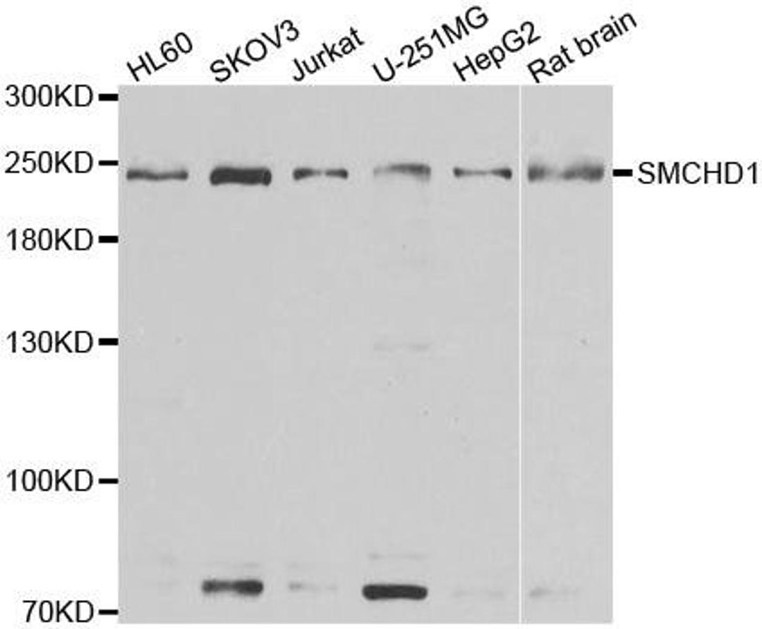 Western blot analysis of extracts of various cell lines using SMCHD1 antibody