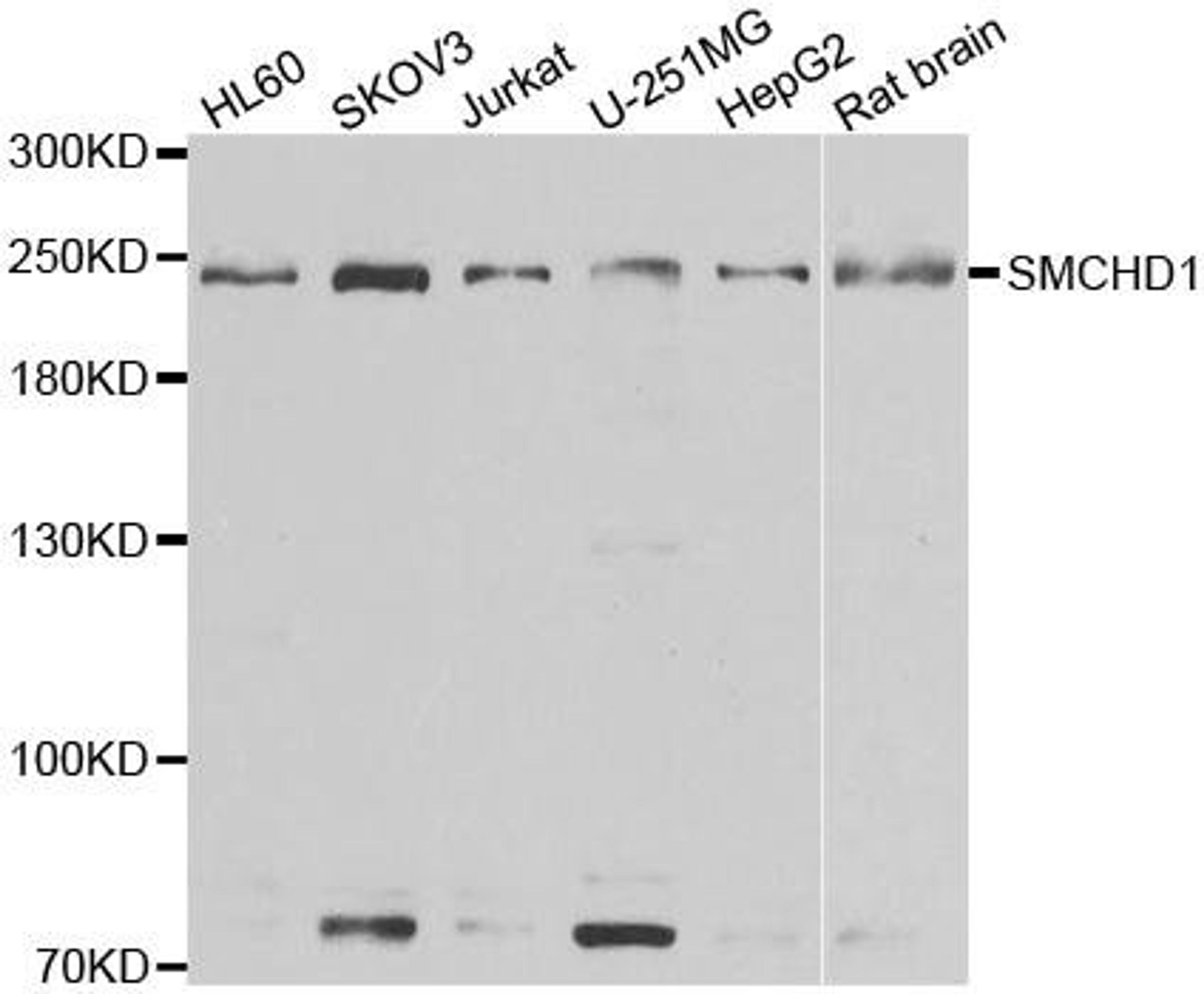 Western blot analysis of extracts of various cell lines using SMCHD1 antibody