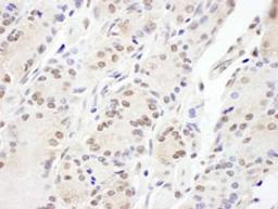 Detection of human Aladin by immunohistochemistry.