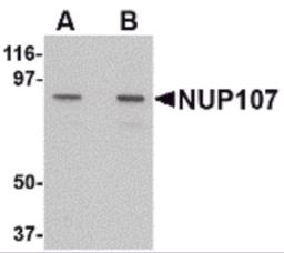 Western blot analysis of NUP107 in A549 cell lysate with NUP107 antibody at (A) 1 and (B) 2 &#956;g/mL.