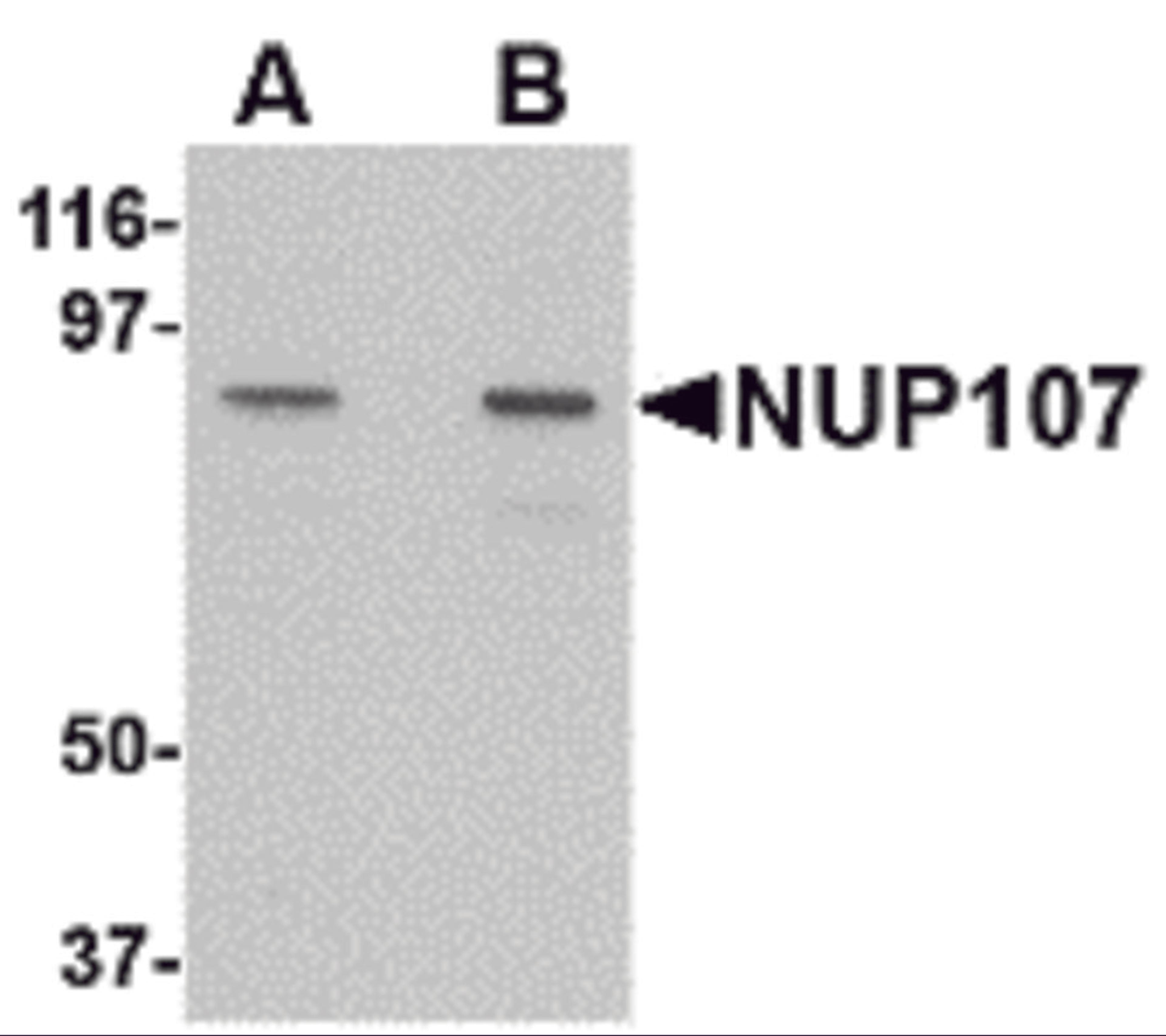 Western blot analysis of NUP107 in A549 cell lysate with NUP107 antibody at (A) 1 and (B) 2 &#956;g/mL.