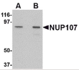 Western blot analysis of NUP107 in A549 cell lysate with NUP107 antibody at (A) 1 and (B) 2 μg/mL.