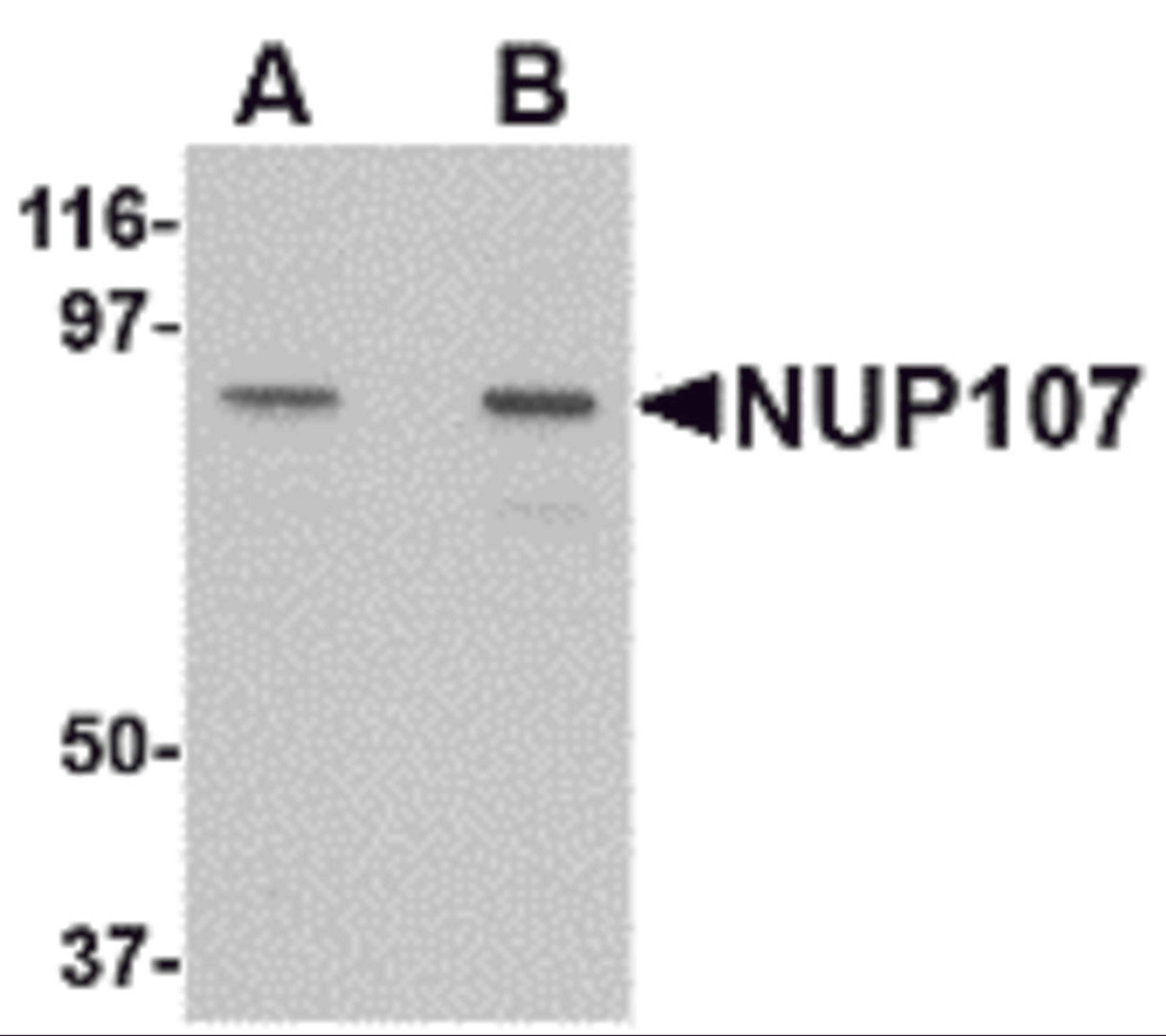 Western blot analysis of NUP107 in A549 cell lysate with NUP107 antibody at (A) 1 and (B) 2 μg/mL.