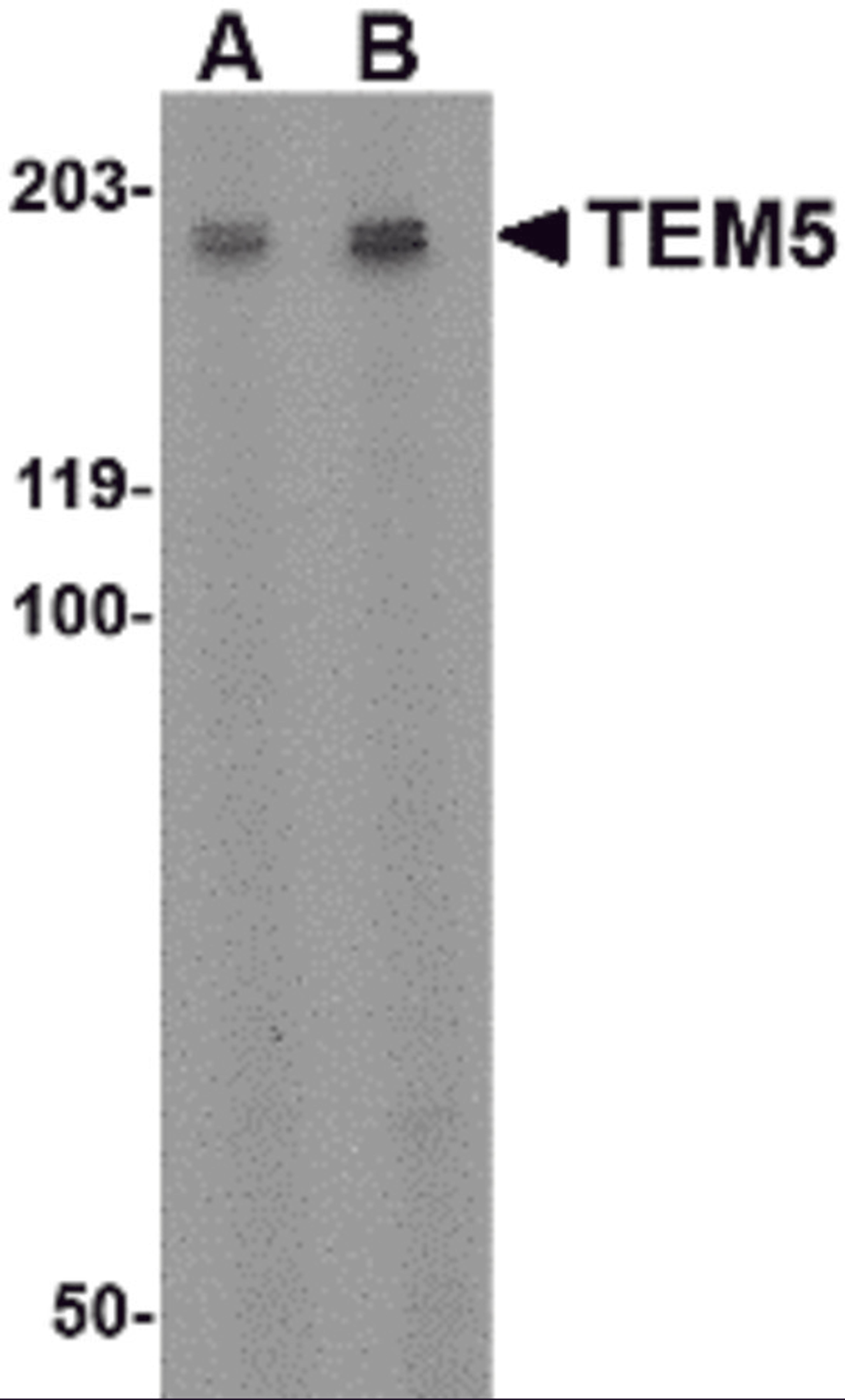 Western blot analysis of TEM5 in rat kidney tissue lysate with TEM5 antibody at (A) 2 &#956;g/ml and (B) 4 &#956;g/mL.