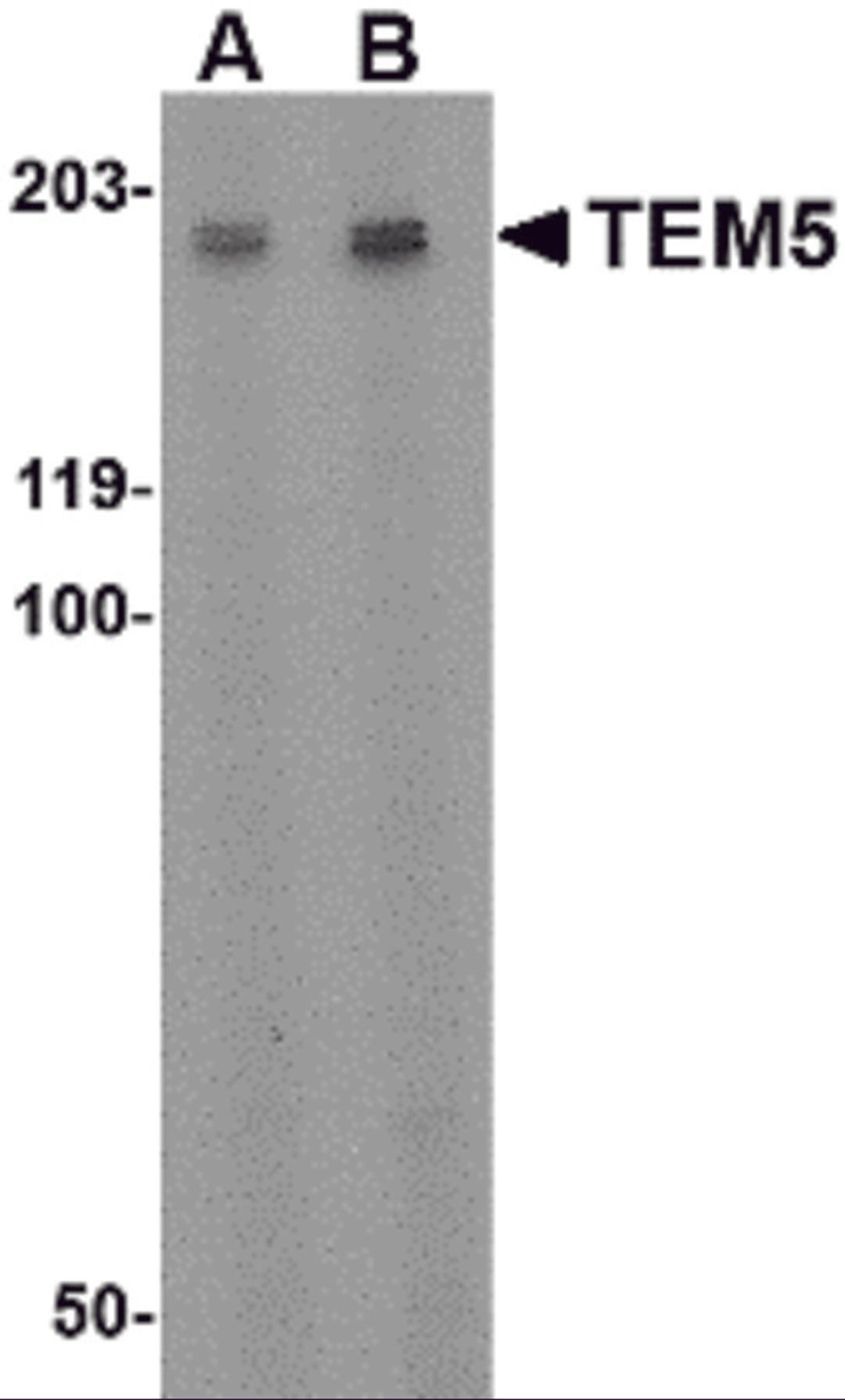 Western blot analysis of TEM5 in rat kidney tissue lysate with TEM5 antibody at (A) 2 μg/ml and (B) 4 μg/mL.