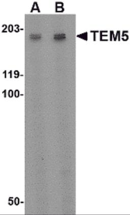 Western blot analysis of TEM5 in rat kidney tissue lysate with TEM5 antibody at (A) 2 μg/ml and (B) 4 μg/mL.