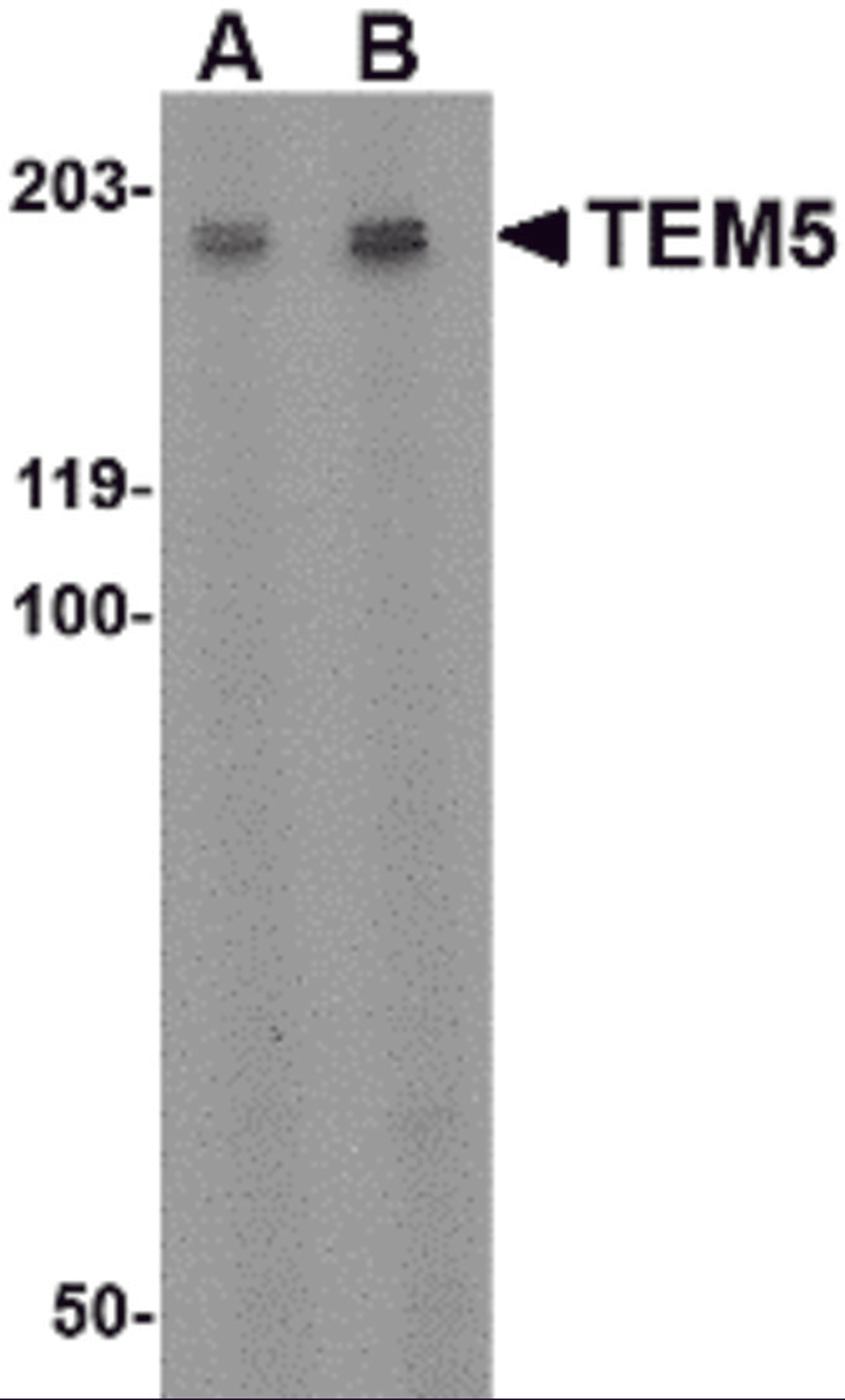 Western blot analysis of TEM5 in rat kidney tissue lysate with TEM5 antibody at (A) 2 μg/ml and (B) 4 μg/mL.