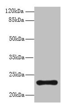 Western blot. All lanes: AP3S2 antibody at 6µg/ml + A549 whole cell lysate. Secondary. Goat polyclonal to rabbit IgG at 1/10000 dilution. Predicted band size: 23, 44, 15 kDa. Observed band size: 23 kDa