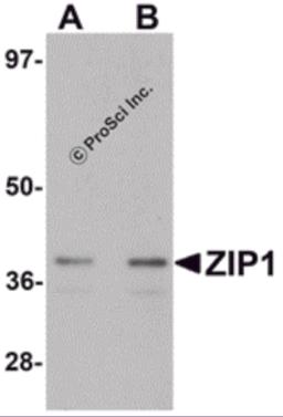 Western blot analysis of ZIP1 in mouse kidney tissue lysate with ZIP1 antibody at (A) 1 and (B) 2 &#956;g/mL.