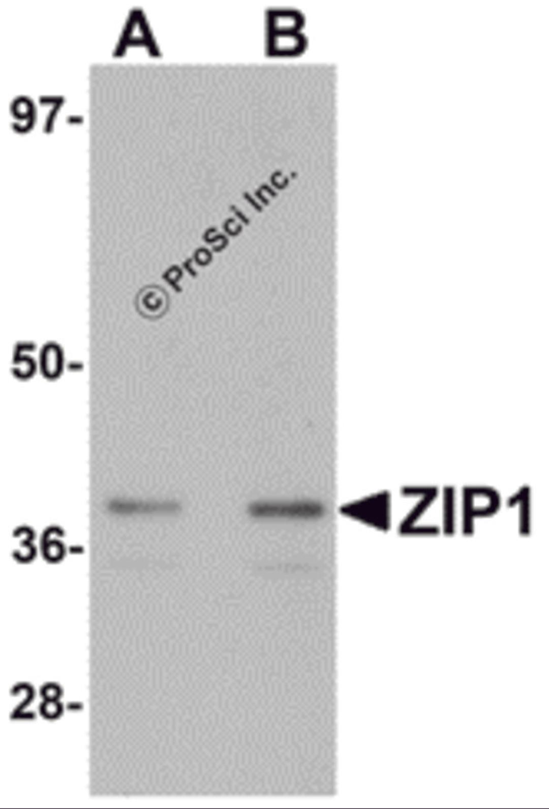Western blot analysis of ZIP1 in mouse kidney tissue lysate with ZIP1 antibody at (A) 1 and (B) 2 μg/mL.