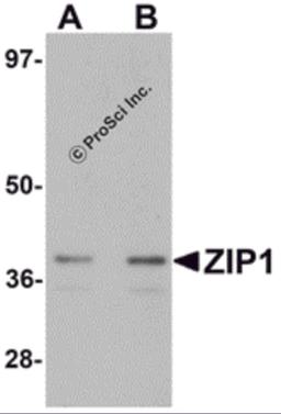 Western blot analysis of ZIP1 in mouse kidney tissue lysate with ZIP1 antibody at (A) 1 and (B) 2 μg/mL.