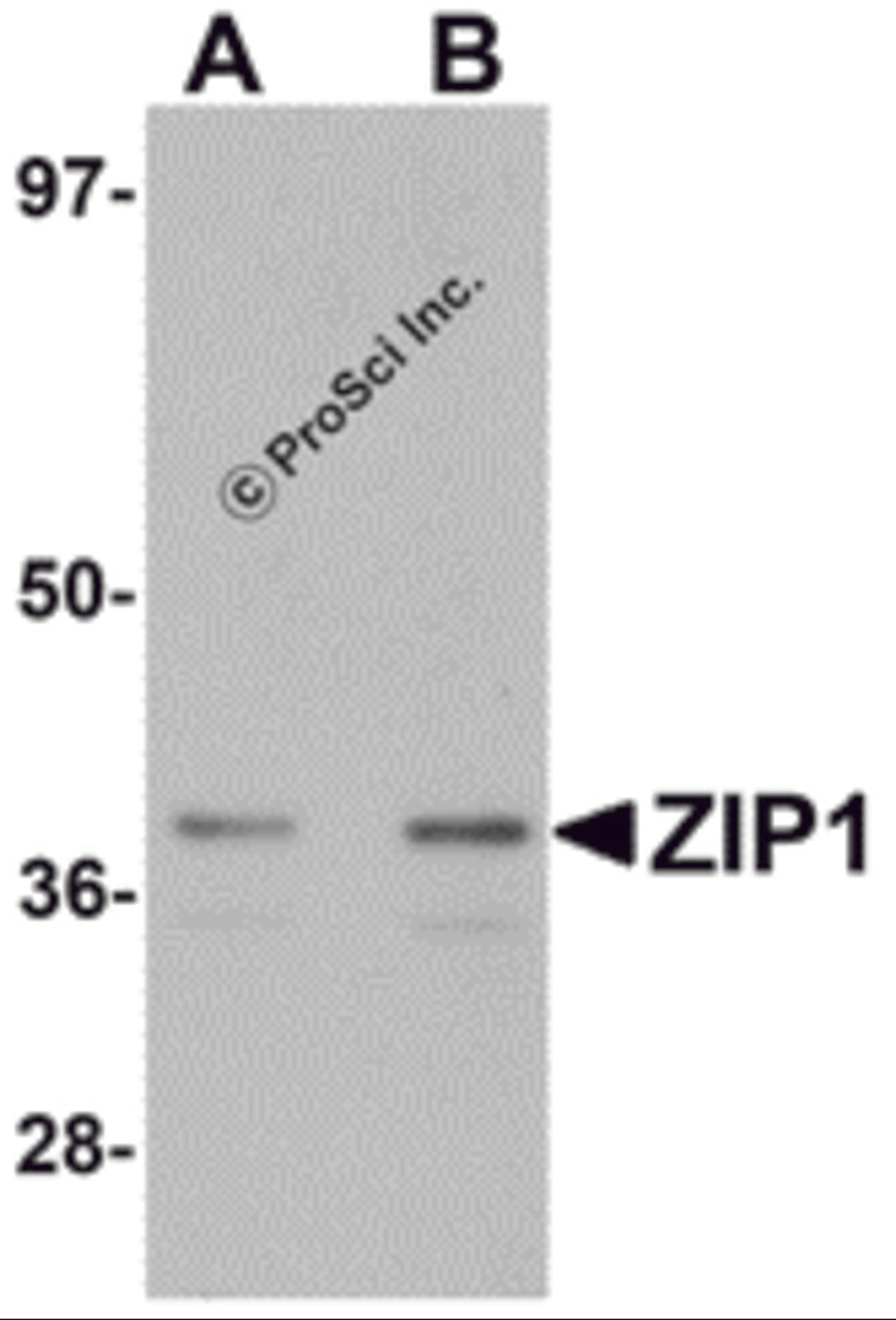 Western blot analysis of ZIP1 in mouse kidney tissue lysate with ZIP1 antibody at (A) 1 and (B) 2 μg/mL.