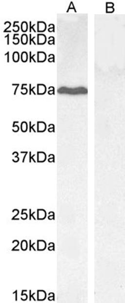 45-649 (0.3ug/ml) staining of HepG2 (A) and negative control KLY (B) lysate (35ug protein in RIPA buffer) Detected by chemiluminescence.