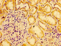Immunohistochemistry of paraffin-embedded human kidney tissue using CSB-PA891731LA01HU at dilution of 1:100