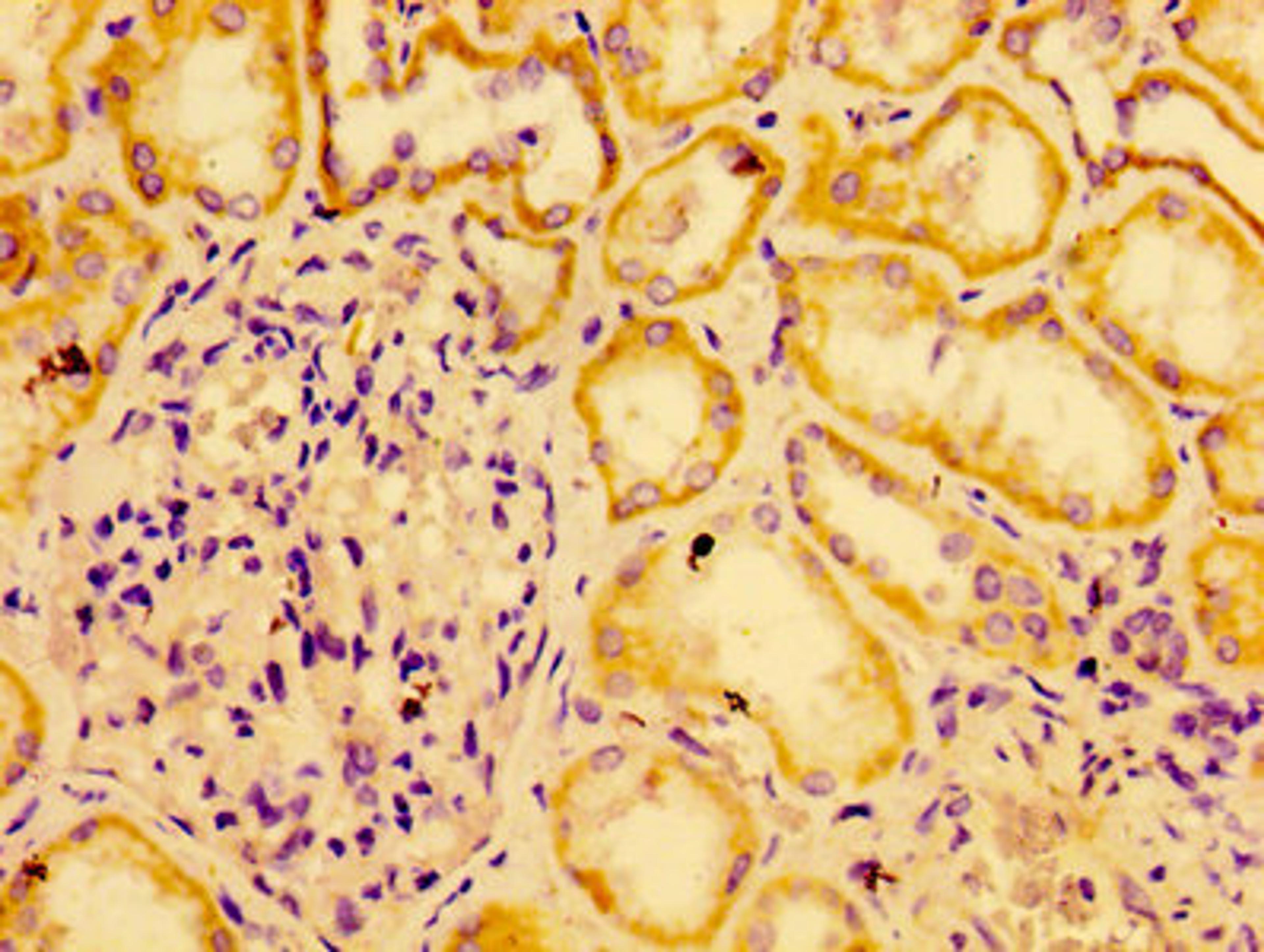 Immunohistochemistry of paraffin-embedded human kidney tissue using CSB-PA891731LA01HU at dilution of 1:100