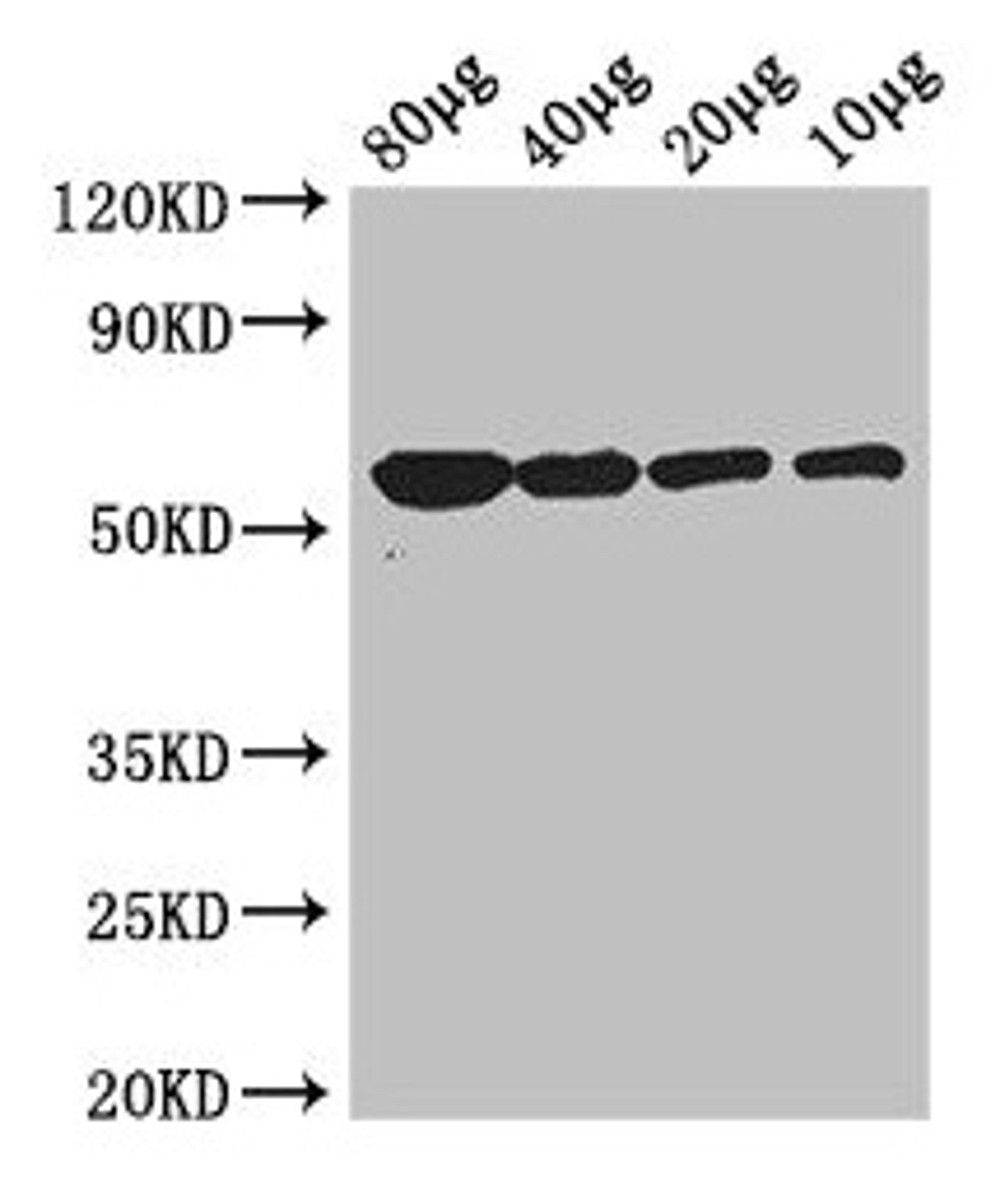 Western Blot. Positive WB detected in: Rosseta bacteria lysate at 80µg, 40µg, 20µg, 10µg. All lanes: glpK antibody at 3µg/ml. Secondary. Goat polyclonal to rabbit IgG at 1/50000 dilution. Predicted band size: 57 kDa. Observed band size: 57 kDa