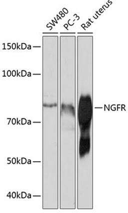 Western blot - NGFR antibody (A19088)