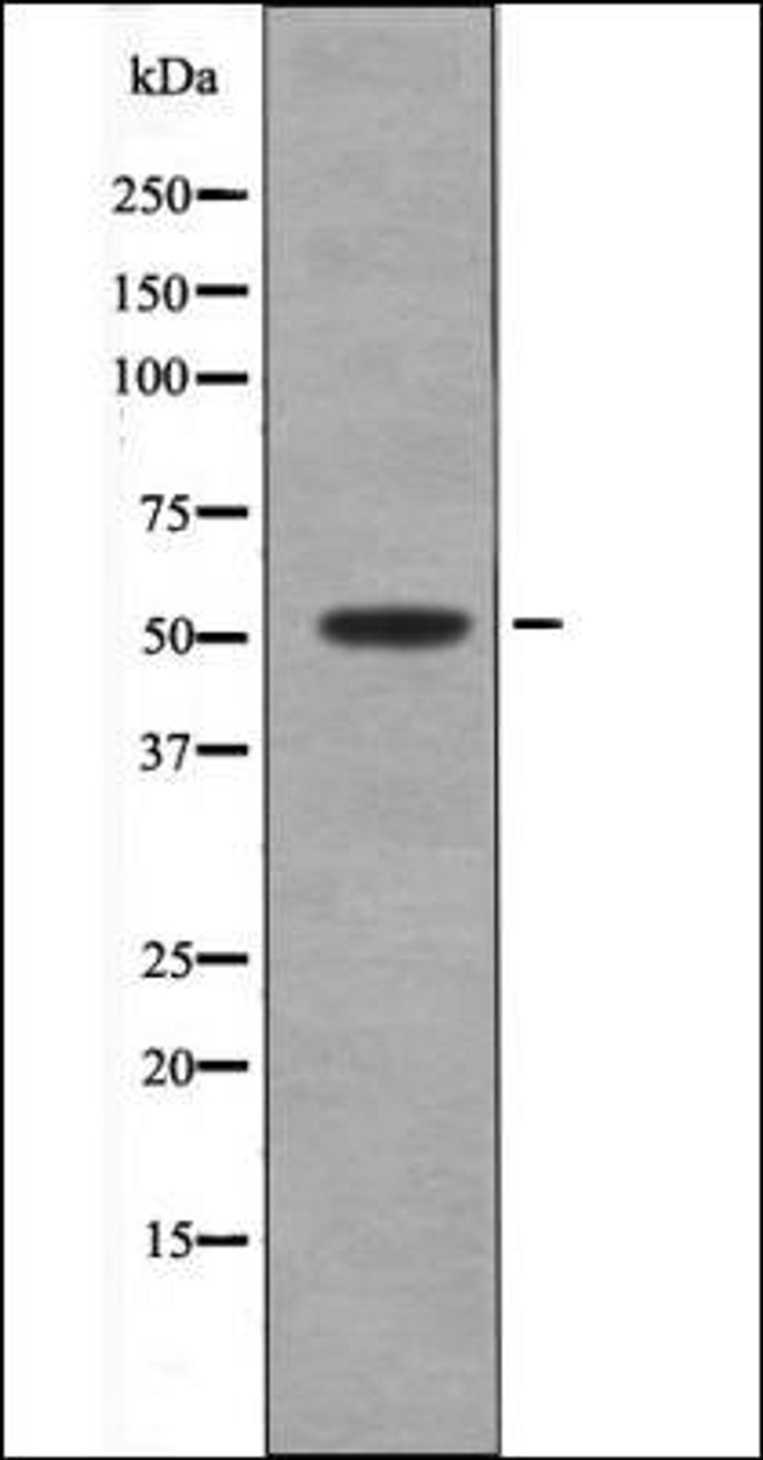 Western blot analysis of Paclitaxel treated Jurkat whole cell lysates using MNK2 -Phospho-Thr24- antibody