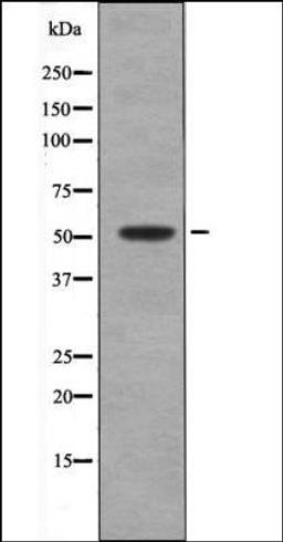 Western blot analysis of Paclitaxel treated Jurkat whole cell lysates using MNK2 -Phospho-Thr24- antibody