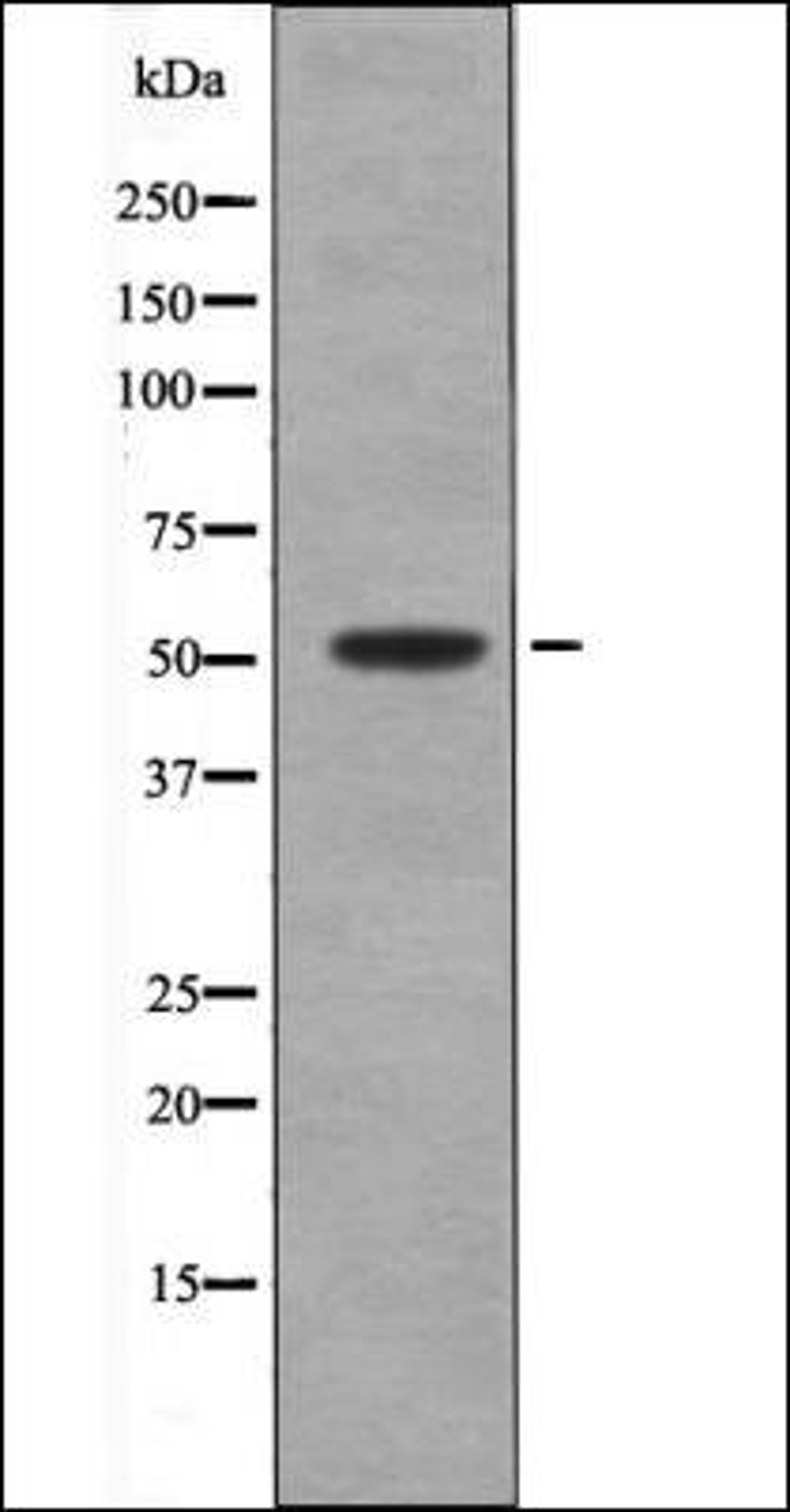 Western blot analysis of Paclitaxel treated Jurkat whole cell lysates using MNK2 -Phospho-Thr24- antibody