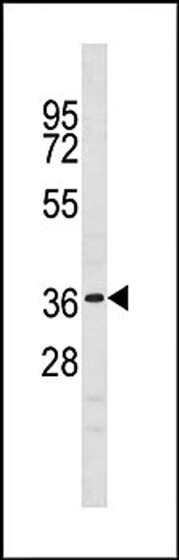 Western blot analysis of mouse liver tissue lysates (35ug/lane) using NKX6-1 (C-term) antibody