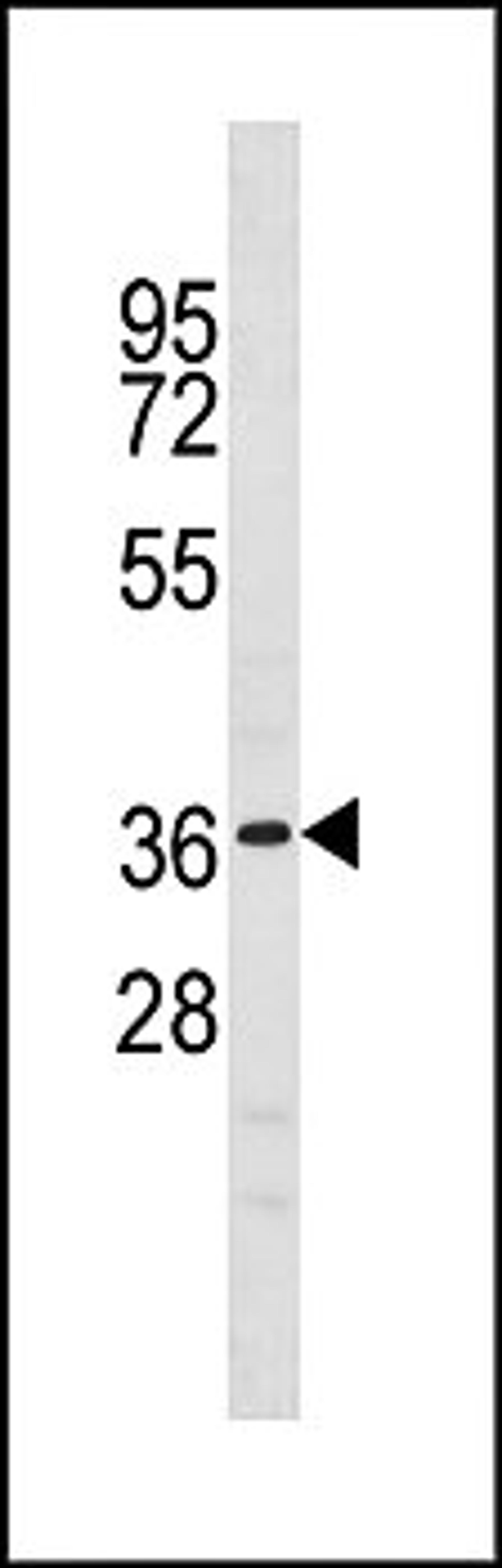 Western blot analysis of mouse liver tissue lysates (35ug/lane) using NKX6-1 (C-term) antibody