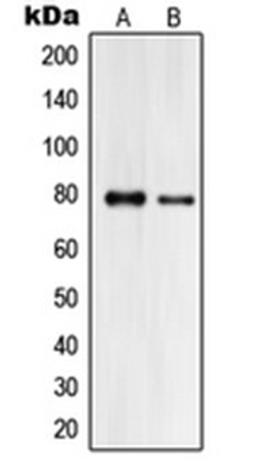 Western blot analysis of HeLa (Lane 1), HL60 (Lane 2) whole cell lysates using PJA2 antibody