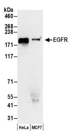 Detection of human EGFR by western blot.