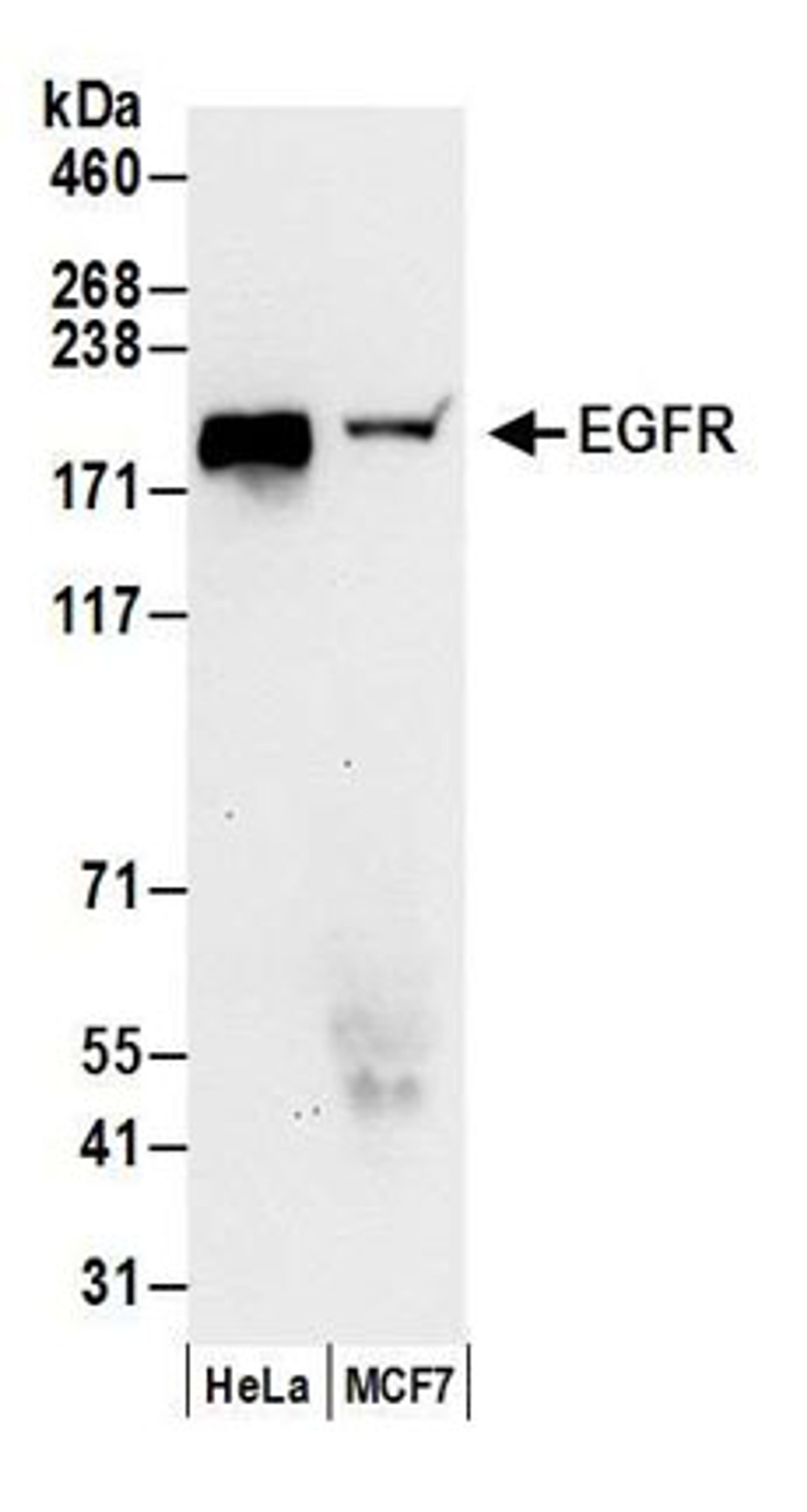 Detection of human EGFR by western blot.