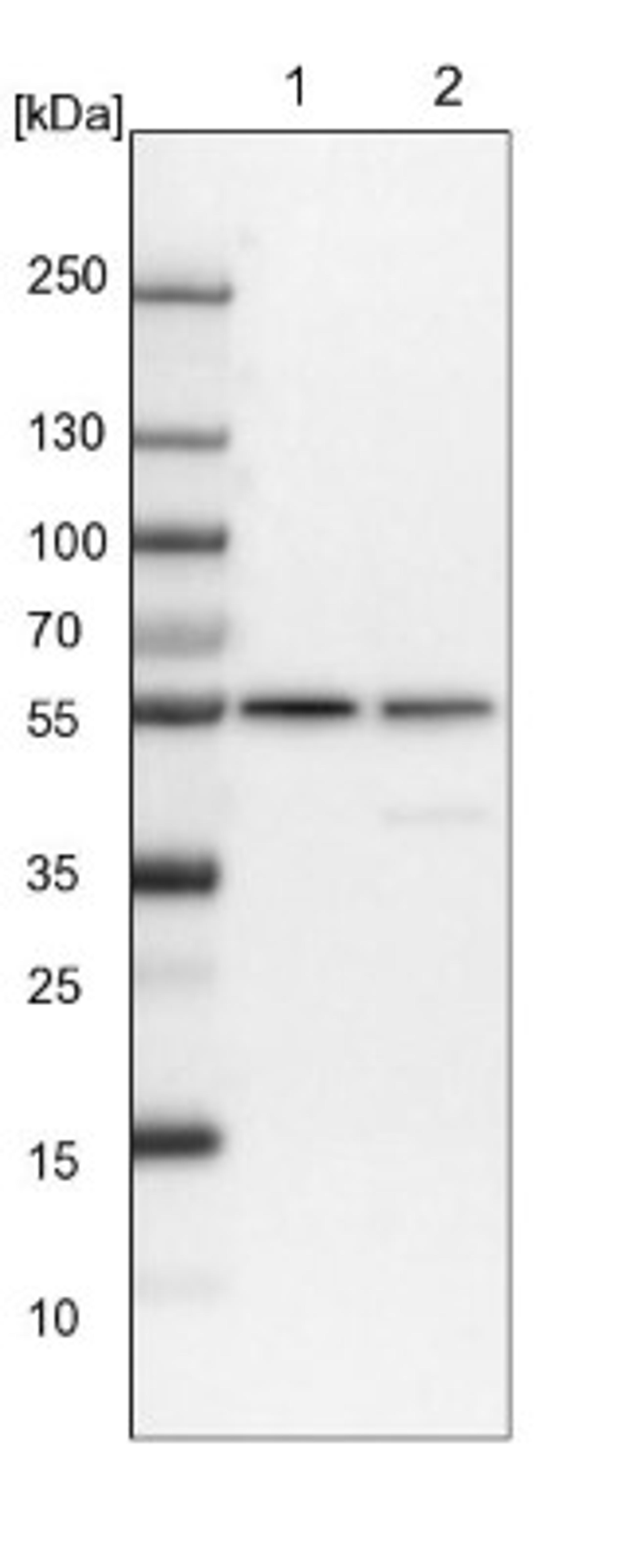 Western Blot: CDKAL1 Antibody [NBP1-83660] - Lane 1: NIH-3T3 cell lysate (Mouse embryonic fibroblast cells)<br/>Lane 2: NBT-II cell lysate (Rat Wistar bladder tumour cells)