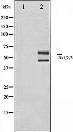 Western blot analysis of 293 whole cell lysates using JNK1/2/3 antibody, The lane on the left is treated with the antigen-specific peptide.