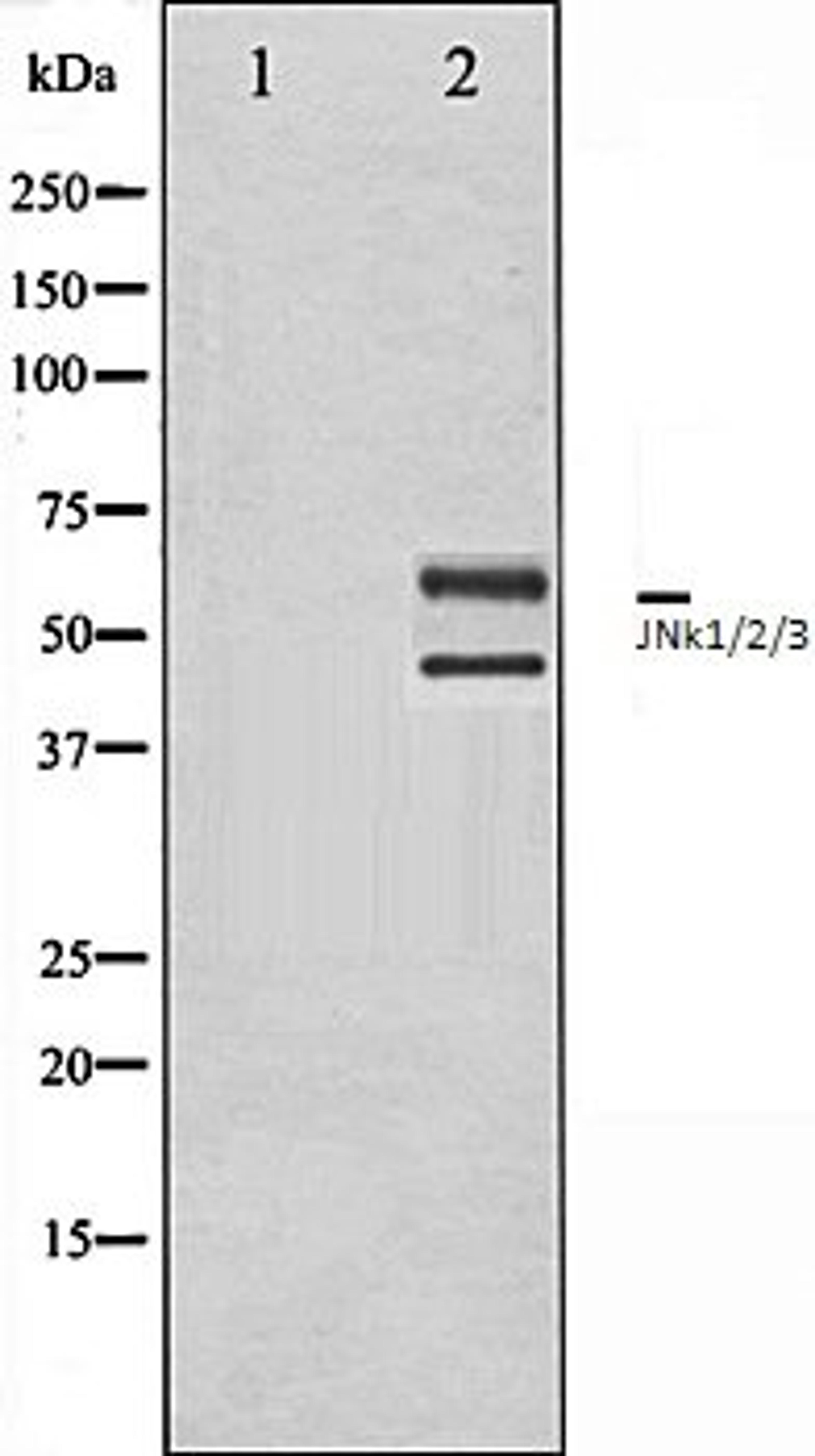 Western blot analysis of 293 whole cell lysates using JNK1/2/3 antibody, The lane on the left is treated with the antigen-specific peptide.