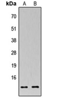 Western blot analysis of HEK293T (Lane1), Raw264.7 (Lane2) whole cell using MRPS33 antibody