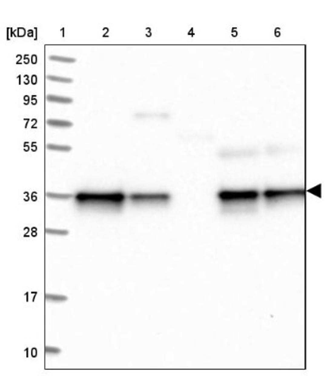 Western Blot: NUBP1 Antibody [NBP1-92205] - Lane 1: Marker [kDa] 250, 130, 95, 72, 55, 36, 28, 17, 10<br/>Lane 2: Human cell line RT-4<br/>Lane 3: Human cell line U-251MG sp<br/>Lane 4: Human plasma (IgG/HSA depleted)<br/>Lane 5: Human liver tissue<br/>Lane 6: Human tonsil tissue