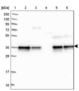 Western Blot: NUBP1 Antibody [NBP1-92205] - Lane 1: Marker [kDa] 250, 130, 95, 72, 55, 36, 28, 17, 10<br/>Lane 2: Human cell line RT-4<br/>Lane 3: Human cell line U-251MG sp<br/>Lane 4: Human plasma (IgG/HSA depleted)<br/>Lane 5: Human liver tissue<br/>Lane 6: Human tonsil tissue