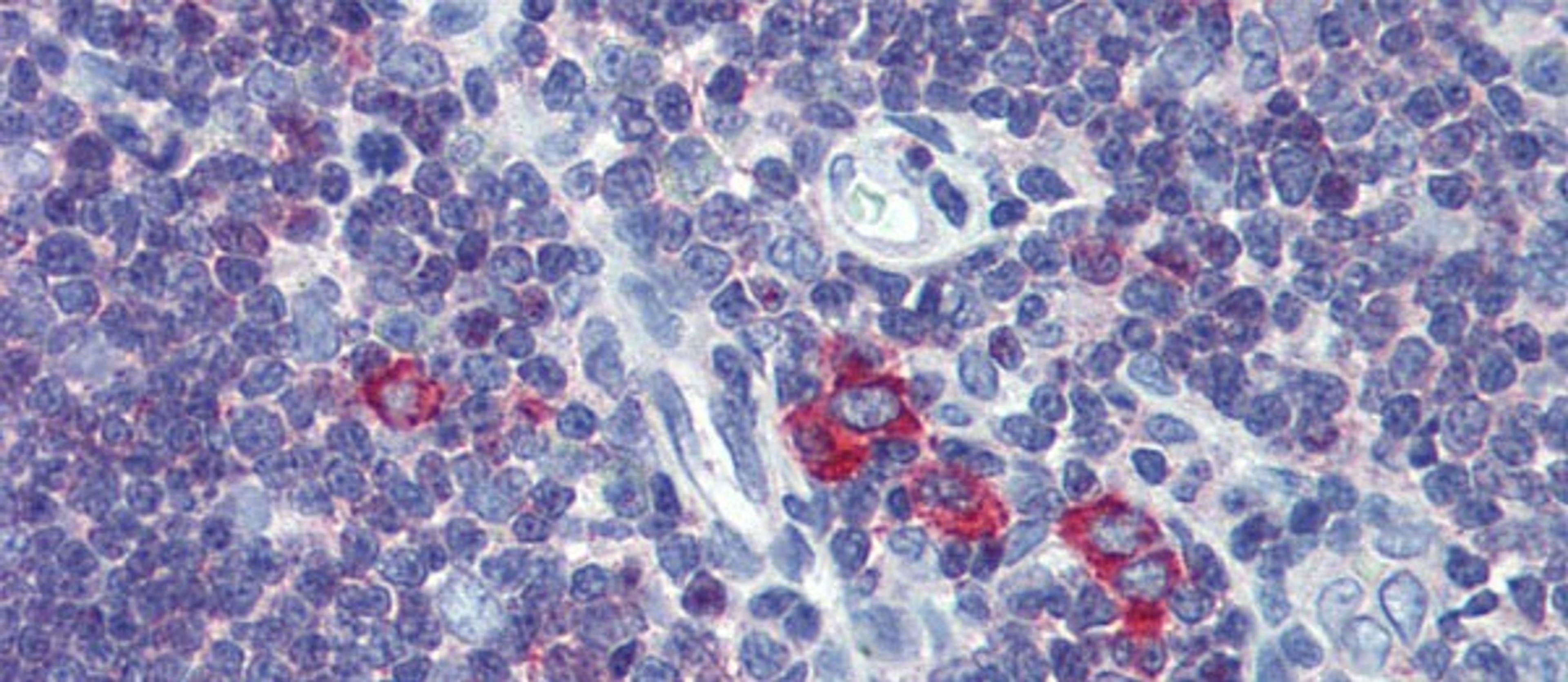 Antibody used in IHC on Human Thymus at 5.0 ug/ml.