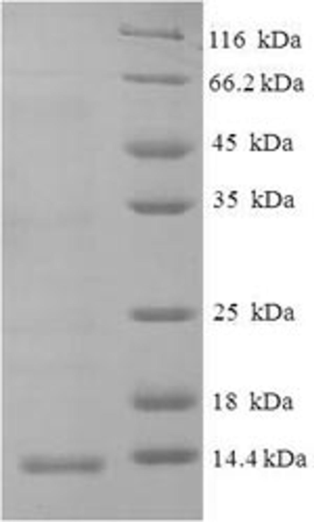 (Tris-Glycine gel) Discontinuous SDS-PAGE (reduced) with 5% enrichment gel and 15% separation gel.