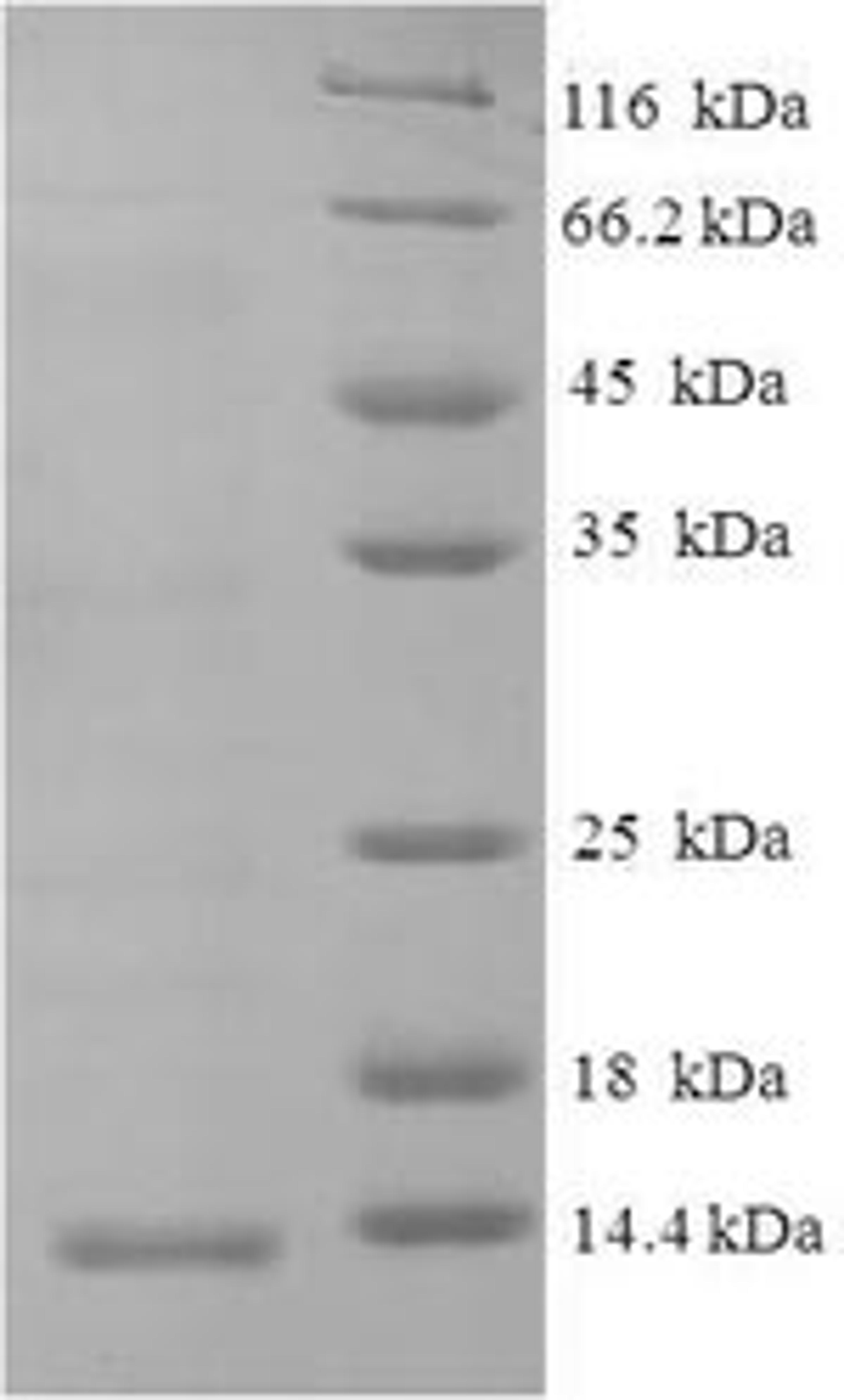 (Tris-Glycine gel) Discontinuous SDS-PAGE (reduced) with 5% enrichment gel and 15% separation gel.