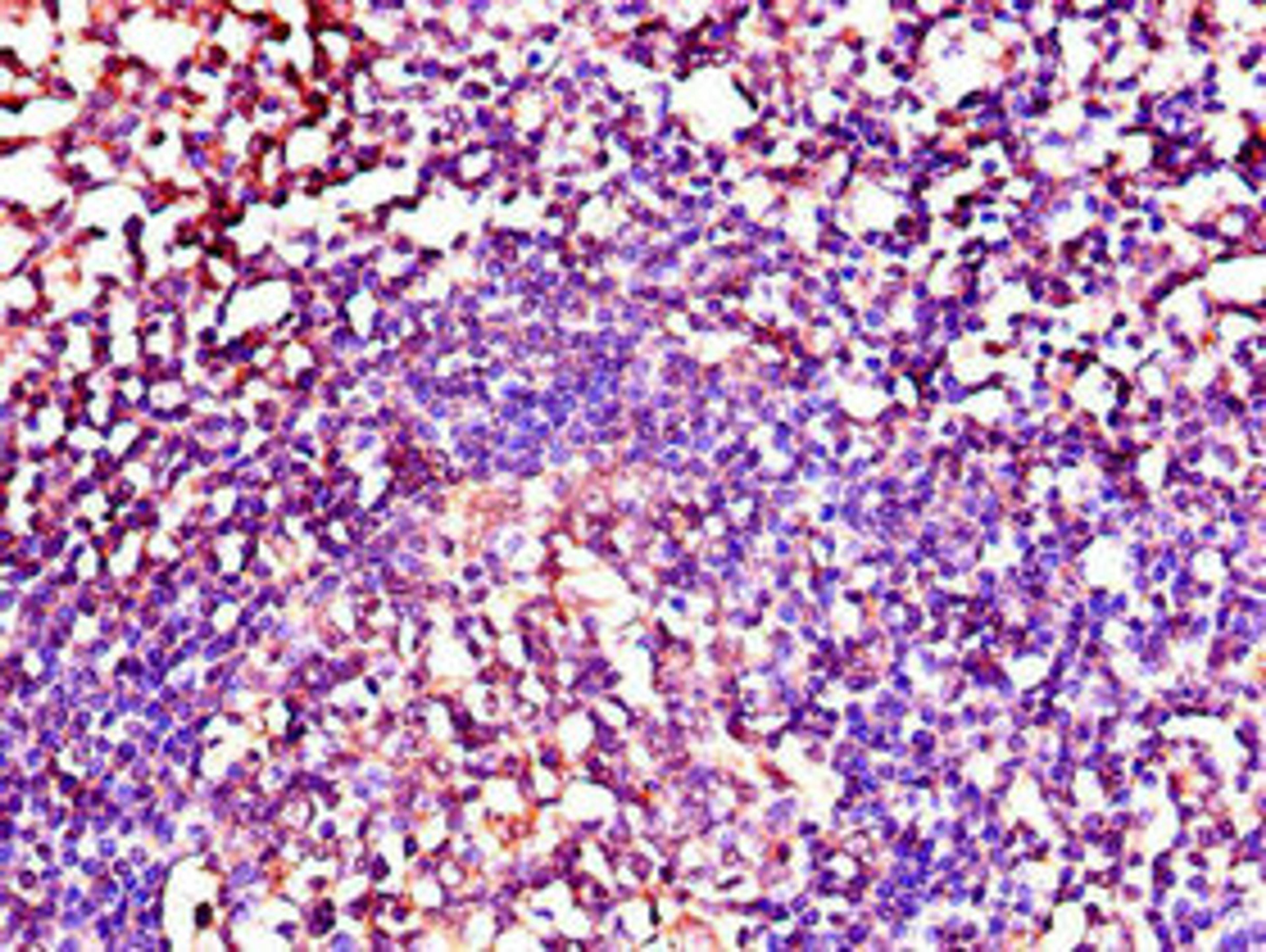 Immunohistochemistry of paraffin-embedded human tonsil tissue using CSB-PA09589A0Rb at dilution of 1:100