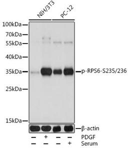 Western blot - Phospho-RPS6-S235/236 antibody (AP0538)