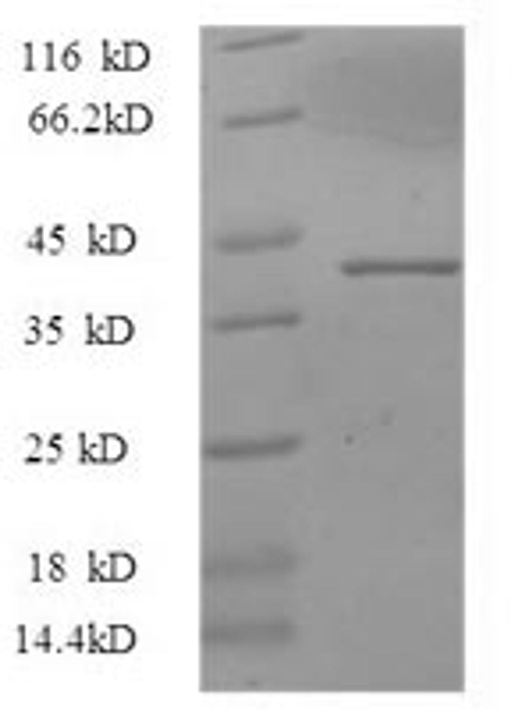 (Tris-Glycine gel) Discontinuous SDS-PAGE (reduced) with 5% enrichment gel and 15% separation gel.