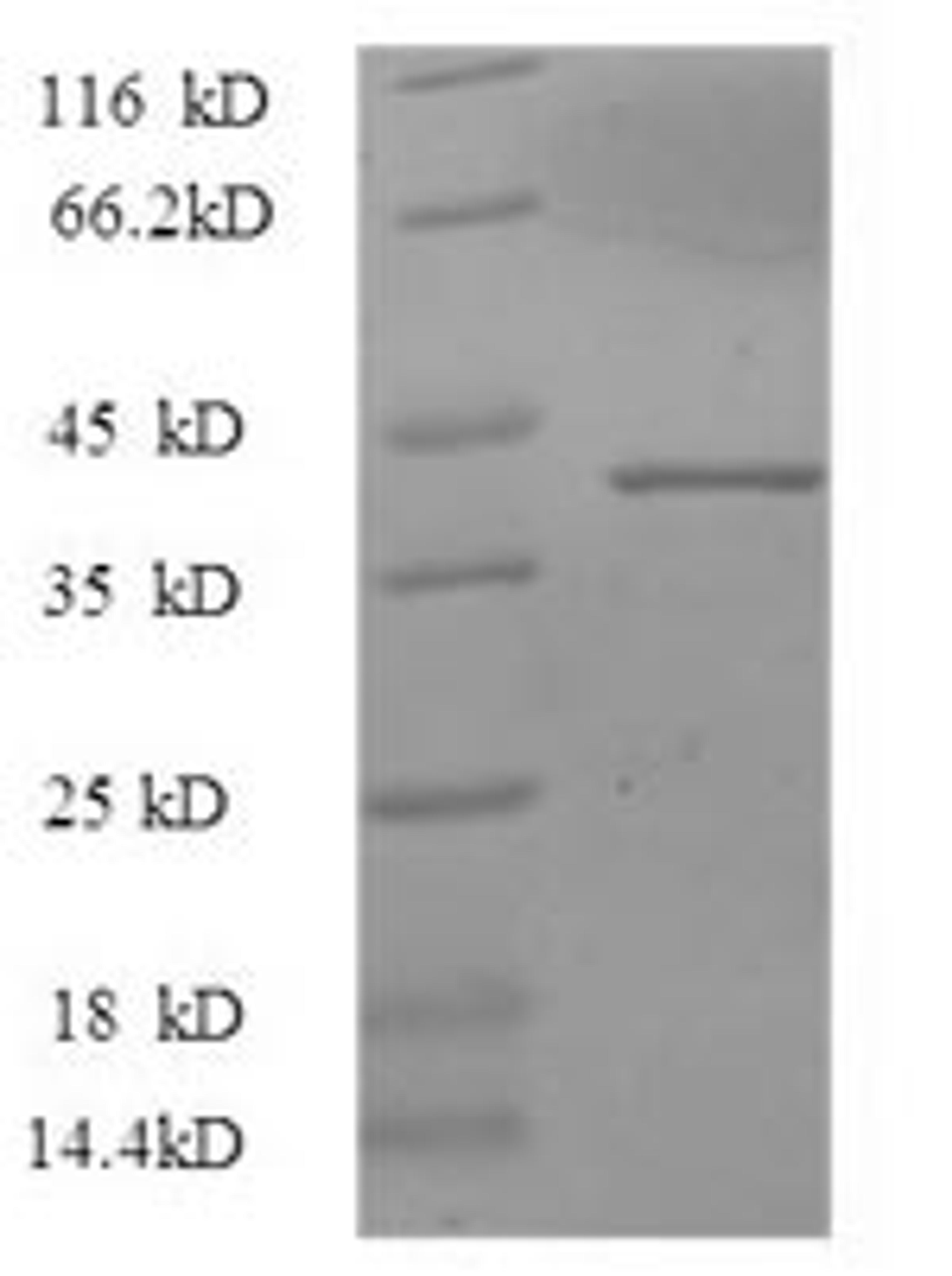 (Tris-Glycine gel) Discontinuous SDS-PAGE (reduced) with 5% enrichment gel and 15% separation gel.
