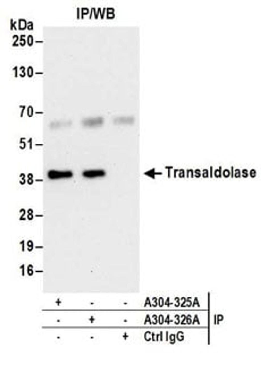 Detection of human Transaldolase by western blot of immunoprecipitates.