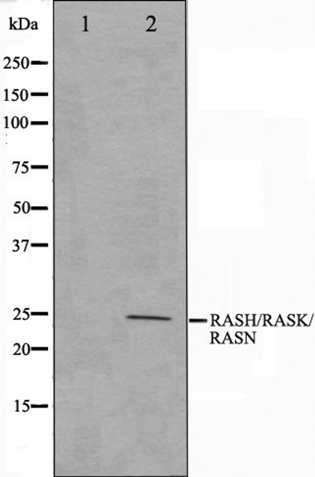 Western blot analysis of HeLa cell lysate using RASH/RASK/RASN antibody