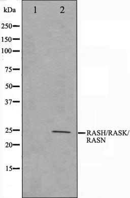 Western blot analysis of HeLa cell lysate using RASH/RASK/RASN antibody