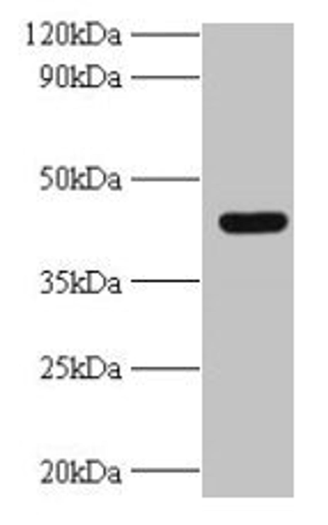 Western blot. All lanes: UBE2Q2 antibody at 2µg/ml + A431 whole cell lysate. Secondary. Goat polyclonal to rabbit IgG at 1/10000 dilution. Predicted band size: 43, 37, 41, 39 kDa. Observed band size: 43 kDa