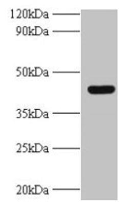 Western blot. All lanes: UBE2Q2 antibody at 2µg/ml + A431 whole cell lysate. Secondary. Goat polyclonal to rabbit IgG at 1/10000 dilution. Predicted band size: 43, 37, 41, 39 kDa. Observed band size: 43 kDa